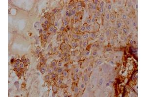 IHC image of ABIN7127406 diluted at 1:100 and staining in paraffin-embedded human placenta tissue performed on a Leica BondTM system. (Recombinant CD55 antibody)
