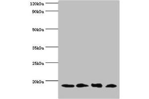 Western blot All lanes: UBE2V2 antibody at 3 μg/mL Lane 1: Hela whole cell lysate Lane 2: Mouse brain tissue Lane 3: Jurkat whole cell lysate Lane 4: K562 whole cell lysate Secondary Goat polyclonal to rabbit IgG at 1/10000 dilution Predicted band size: 16 kDa Observed band size: 16 kDa (UBE2V2 antibody  (AA 1-145))