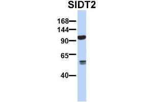 Host:  Rabbit  Target Name:  SERPINA3  Sample Type:  Human Adult Placenta  Antibody Dilution:  1. (SIDT2 antibody  (N-Term))