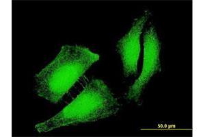 Immunofluorescence of monoclonal antibody to FOXO3 on HeLa cell. (FOXO3 antibody  (AA 361-460))
