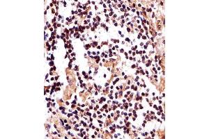 Immunohistochemical analysis of paraffin-embedded H. (IZUMO2 antibody  (AA 90-124))