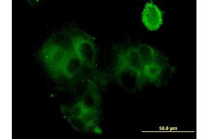 Immunofluorescence of monoclonal antibody to GCA on MCF-7 cell. (Grancalcin antibody  (AA 1-217))
