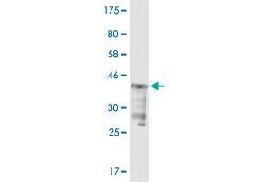 Western Blot detection against Immunogen (37. (USP5 antibody  (AA 71-180))