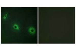 Immunofluorescence analysis of HepG2 cells, using CELSR3 antibody. (CELSR3 antibody)