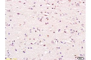 Formalin-fixed and paraffin embedded mouse heart labeled with Anti phospho-PI3K p85/PIK3R1(Tyr368) Polyclonal Antibody, Unconjugated (ABIN711041) at 1:200 followed by conjugation to the secondary antibody and DAB staining (PIK3R1 antibody  (pTyr368))