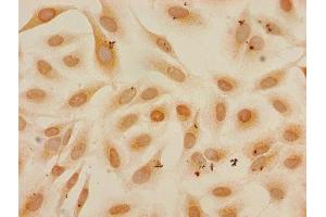 Immunocytochemistry (ICC) image for anti-Histone Cluster 1, H3a (HIST1H3A) (meLys27) antibody (ABIN7139597)