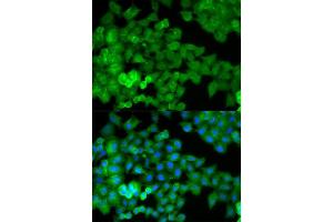 Immunofluorescence analysis of HeLa cell using JUP antibody. (JUP antibody  (AA 1-300))