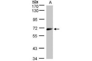 WB Image Sample(30 ug whole cell lysate) A:A431, 7. (IL12RB1 antibody)