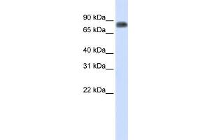 WB Suggested Anti-MST1 Antibody Titration:  0. (MST1 antibody  (Middle Region))