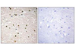 Immunohistochemistry (IHC) image for anti-Tumor Protein P73 (TP73) (Internal Region) antibody (ABIN1848961) (Tumor Protein p73 antibody  (Internal Region))