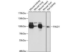 Western blot analysis of extracts of various cell lines, using P antibody (ABIN6133270, ABIN6145194, ABIN6145195 and ABIN6216692) at 1:3000 dilution. (KIAA1274 antibody  (AA 1-300))