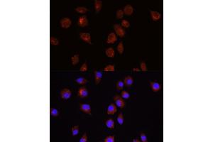 Immunofluorescence analysis of L929 cells using  antibody (ABIN6127334, ABIN6136734, ABIN6136739 and ABIN6221182) at dilution of 1:100. (AKT1 antibody  (AA 1-150))