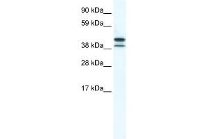 WB Suggested Anti-TRF3 Antibody Titration:  5. (Tbpl2 antibody  (N-Term))