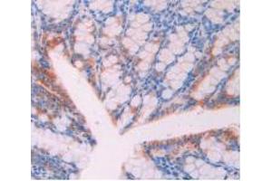 Figure. (CD47 antibody  (AA 18-219))