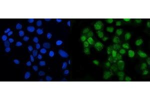 IF analysis of LSM8 using anti-LSM8 antibody (ABIN7599579).