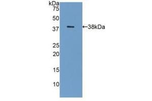 Western blot analysis of recombinant Human GAL8. (LGALS8 antibody  (AA 1-317))