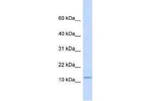 WB Suggested Anti-C9orf46 Antibody Titration:  0. (PLGRKT antibody  (Middle Region))