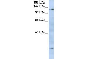 WB Suggested Anti-FMNL2 Antibody Titration:  0. (FMNL2 antibody  (N-Term))