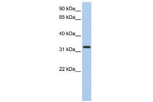 C12ORF24 antibody used at 1 ug/ml to detect target protein. (C12ORF24 antibody  (N-Term))