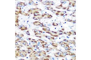 Immunohistochemistry of paraffin-embedded human liver using Presenilin 1 Rabbit pAb (ABIN3023159, ABIN3023160, ABIN3023161 and ABIN6219418) at dilution of 1:100 (40x lens). (Presenilin 1 antibody  (AA 1-160))