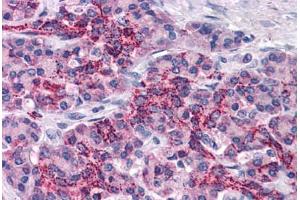 Human Pancreas: Formalin-Fixed, Paraffin-Embedded (FFPE) (XIAP antibody  (AA 75-226))