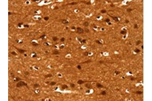 The image on the left is immunohistochemistry of paraffin-embedded Human brain tissue using ABIN7190038(CACNA1E Antibody) at dilution 1/15, on the right is treated with synthetic peptide. (CACNA1E antibody)