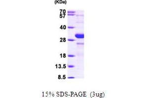 SDS-PAGE (SDS) image for Hypoxia Inducible Factor 1, alpha Subunit (Basic Helix-Loop-Helix Transcription Factor) (HIF1A) (AA 576-785) protein (His tag) (ABIN667163) (HIF1A Protein (AA 576-785) (His tag))