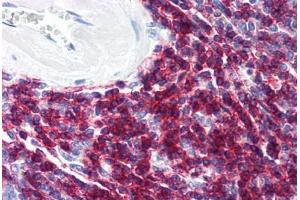 Human Spleen (formalin-fixed, paraffin-embedded) stained with CD6 antibody ABIN294221 at 10 ug/ml followed by biotinylated anti-mouse IgG secondary antibody ABIN481714, alkaline phosphatase-streptavidin and chromogen. (CD6 antibody)