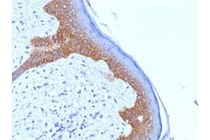 Immunohistochemical staining (Formalin-fixed paraffin-embedded sections) of human skin with DSG3 monoclonal antibody, clone 5G11 . (Desmoglein 3 antibody  (Extracellular Domain))