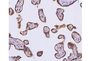 IHC analysis of ATP5F1B using anti-ATP5F1B antibody (ABIN7599866). (Atp5f1b (AA 123-529) antibody)