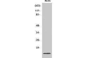 Western Blotting (WB) image for anti-Tumor Protein P53 Inducible Protein 11 (TP53I11) (Internal Region) antibody (ABIN6283821) (TP53I11 antibody  (Internal Region))