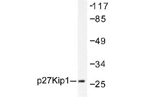 Image no. 1 for anti-Cyclin-Dependent Kinase Inhibitor 1B (p27, Kip1) (CDKN1B) antibody (ABIN271763) (CDKN1B antibody)