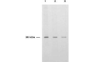 Anti-TS is shown to detect thymidylate synthase present in a HeLa cell extract.