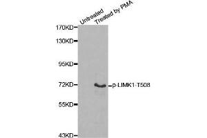 Western blot analysis of extracts from Hela cells, using Phospho-LIMK1-T508 antibody. (LIM Domain Kinase 1 antibody  (pThr508))