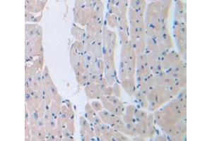Figure. (LAMa4 antibody  (AA 102-234))