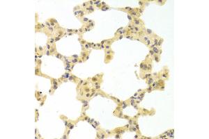 Immunohistochemistry of paraffin-embedded rat lung using IRF3 antibody (ABIN4904080) at dilution of 1:100 (40x lens).