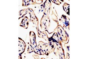 (ABIN6242136 and ABIN6578441) staining ERVK-7 in human placenta tissue sections by Immunohistochemistry (IHC-P - paraformaldehyde-fixed, paraffin-embedded sections). (ERVK-7 antibody  (AA 96-128))