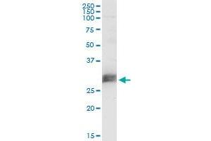 CD151 monoclonal antibody (M02), clone 1B2. (CD151 antibody  (AA 1-253))