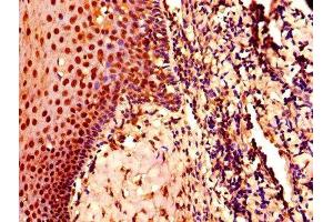 IHC image of ABIN7148865 diluted at 1:800 and staining in paraffin-embedded human tonsil tissue performed on a Leica BondTM system. (CDK2 antibody  (AA 1-298))