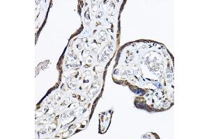Immunohistochemistry of paraffin-embedded human placenta using P Rabbit pAb (ABIN6130631, ABIN6145213, ABIN6145214 and ABIN6214119) at dilution of 1:50 (40x lens). (PAP Associated Domain Containing 7 (PAPD7) (AA 303-542) antibody)