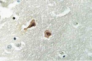 Immunohistochemistry (IHC) analyzes of VCP antibody in paraffin-embedded human brain tissue. (VCP antibody)