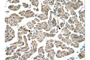 NEU1 antibody was used for immunohistochemistry at a concentration of 4-8 ug/ml. (NEU1 antibody)