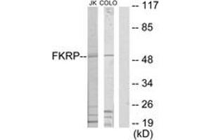 Western blot analysis of extracts from Jurkat/COLO205 cells, using FKRP Antibody.