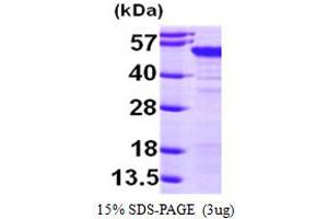SDS-PAGE (SDS) image for Melanoma Antigen Family A, 4 (MAGEA4) (AA 1-317) protein (His tag) (ABIN667021) (MAGEA4 Protein (AA 1-317) (His tag))