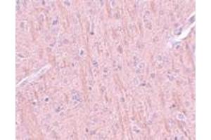 Immunohistochemistry (IHC) image for anti-Coiled-Coil Domain Containing 106 (CCDC106) (C-Term) antibody (ABIN1030324)