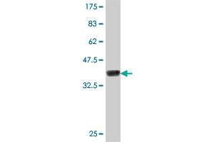 Western Blot detection against Immunogen (37. (TNPO2 antibody  (AA 201-300))