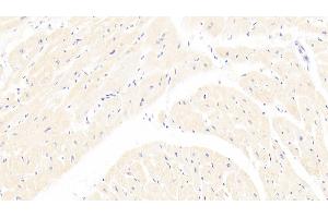 Detection of Lpa in Human Cardiac Muscle Tissue using Polyclonal Antibody to Lipoprotein, a (Lpa) (Lp(a) antibody  (AA 1719-2038))