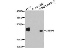 Immunoprecipitation analysis of 200ug extracts of HepG2 cells using 1ug CSRP1 antibody. (CSRP1 antibody)