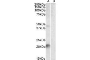 Western Blotting (WB) image for anti-Kallikrein 6 (KLK6) (C-Term) antibody (ABIN2464235) (Kallikrein 6 antibody  (C-Term))