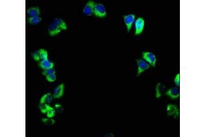 Immunofluorescence staining of PC-3 cells with ABIN7158533 at 1:166, counter-stained with DAPI. (FCER2 antibody  (AA 48-321))